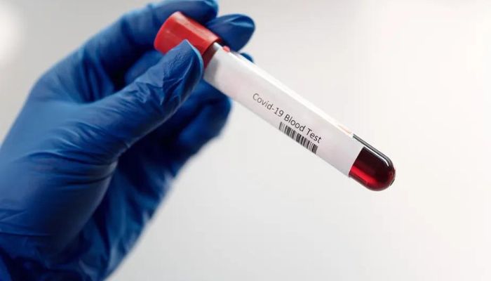 Covid longa: primeiro teste de sangue para diagnosticar quadro é aprovado